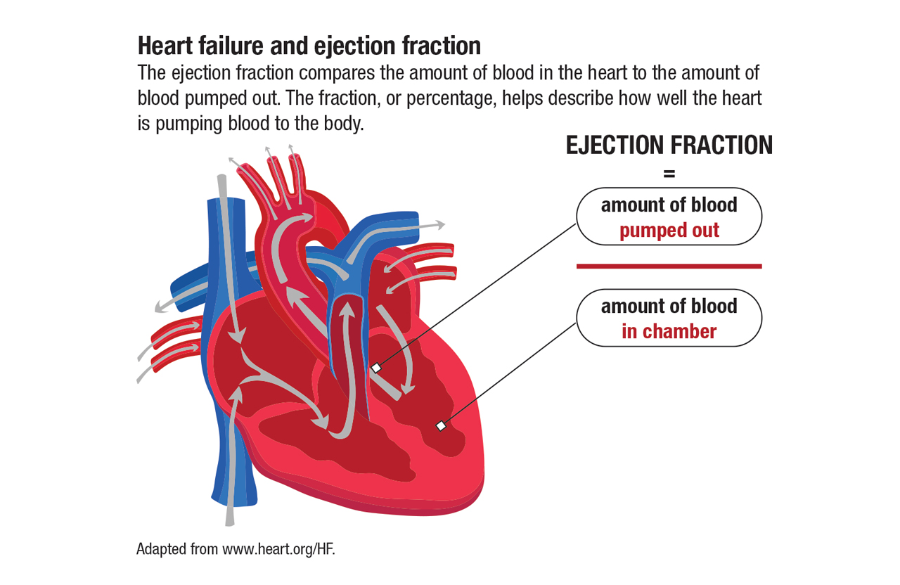 Infographic detailing heart failure and ejection fraction.