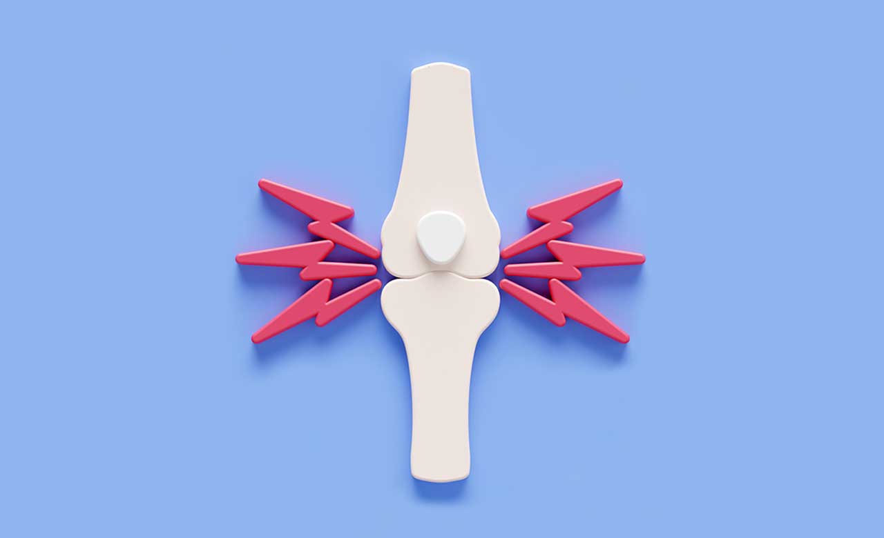 ACP Updates Osteoporosis And Low Bone Mass Guidelines acp-updates-osteoporosis-and-low-bone-mass-guidelines