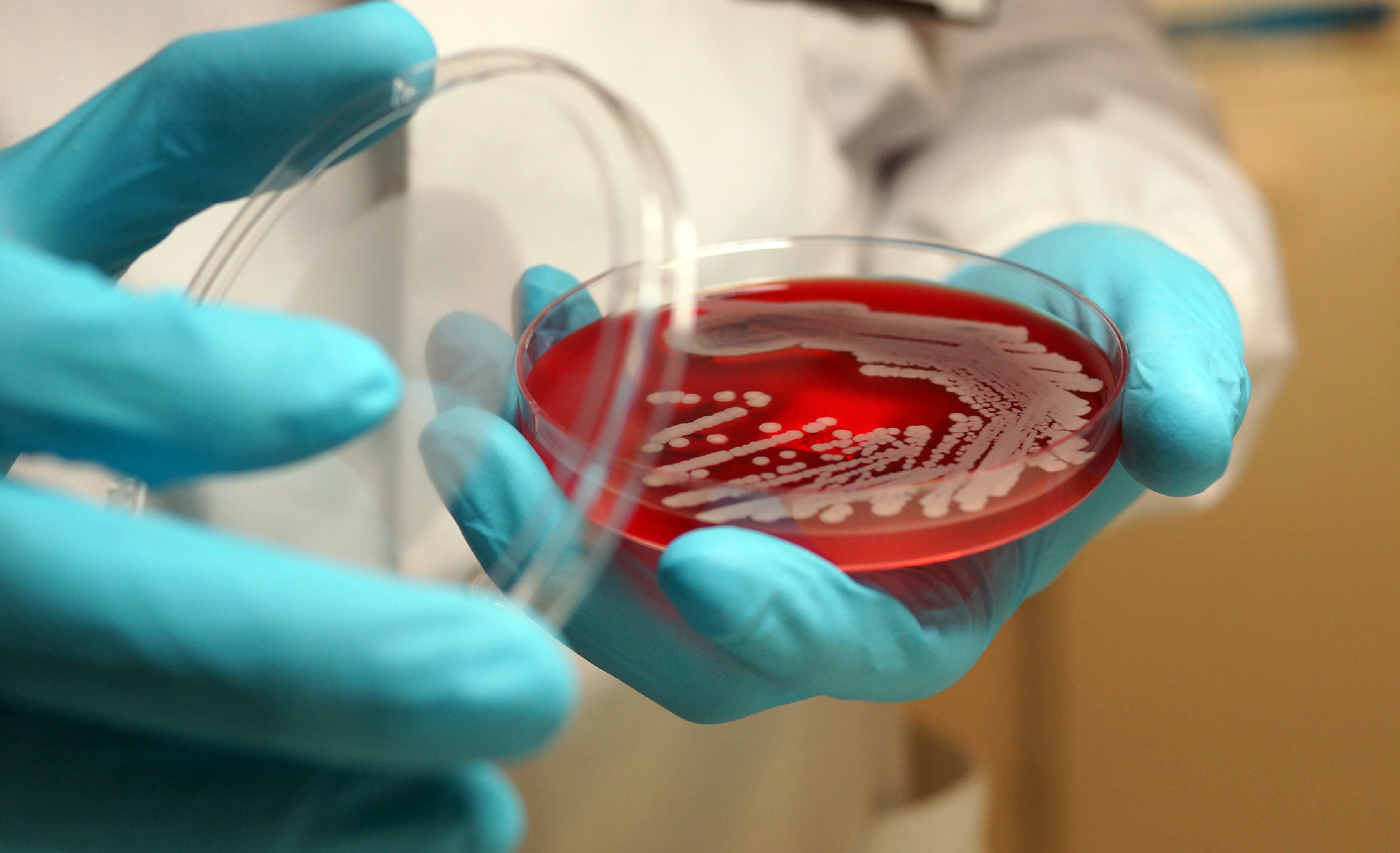 Close up of a bacterial culture in red agar, held by blue gloved hands wearing a white coat
