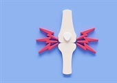 ACP updates osteoporosis and low bone mass guidelines