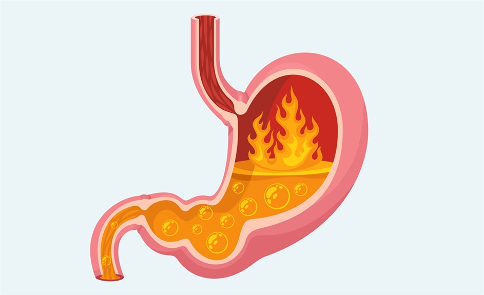 Gastrointestinal distress