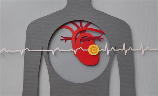 Study provides insights on ideal DOAC timing for patients with AFib post stroke