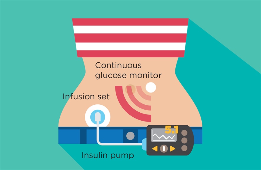 Diabetes care AIDed by new digital technologies