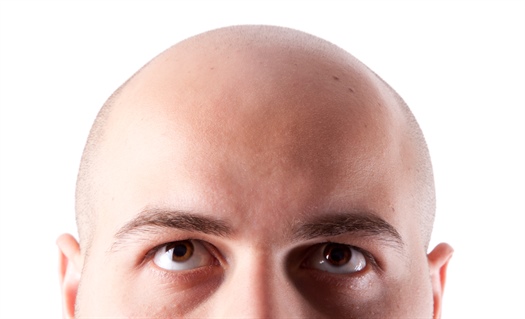 Hair loss