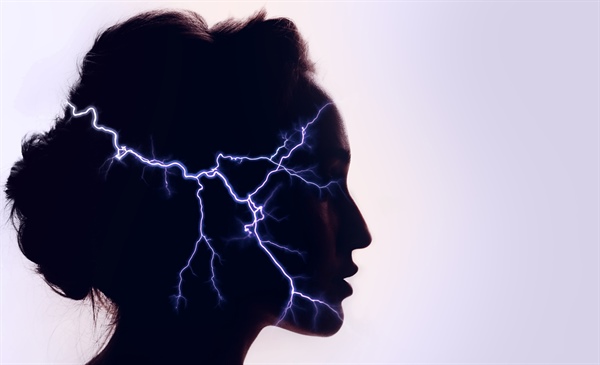 Experts recommend calcitonin gene-related peptide targeting therapies as first-line treatment for migraine