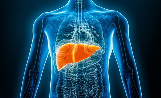 Rezdiffra for liver scarring