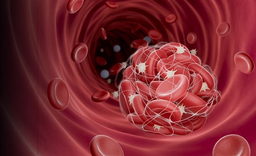 Researchers evaluate diagnostic practices for heparin-induced thrombocytopenia