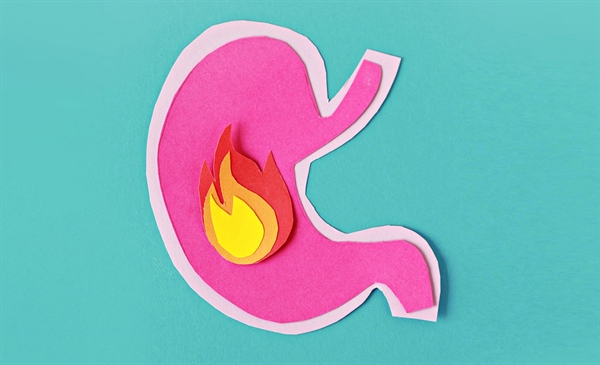 Answering burning questions about heartburn and indigestion aids