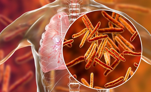 Treating latent tuberculosis