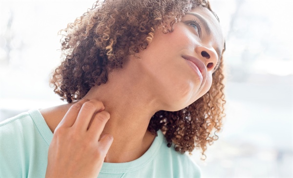 Atopic dermatitis and dry skin