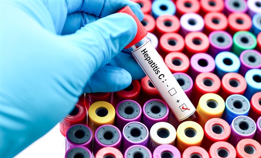 CDC issues guidance on exposure to HCV for health professionals