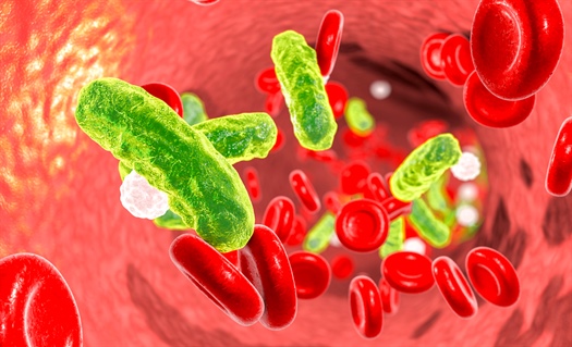 Study suggests practitioners may want to wait before giving antibiotics for sepsis