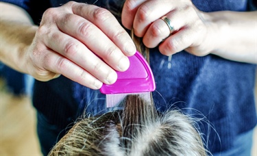 Head lice: A hairy situation