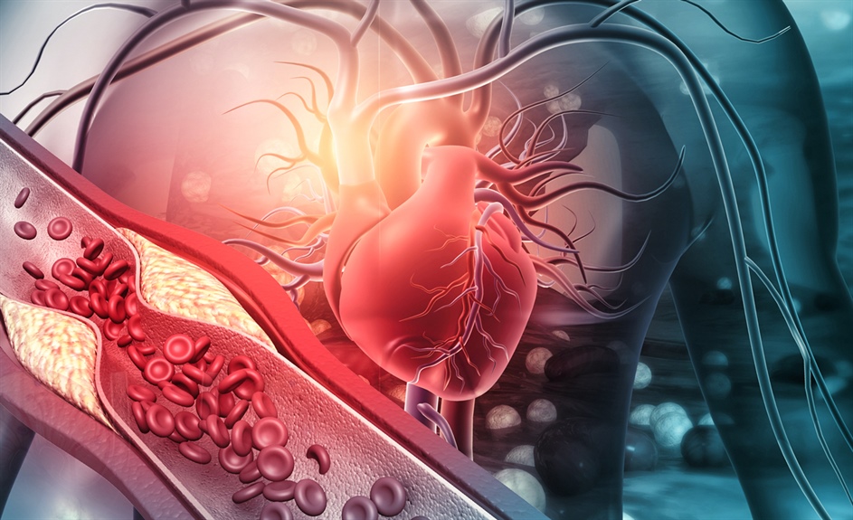 Caution when restarting clozapine: Potential for severe cardiovascular effects