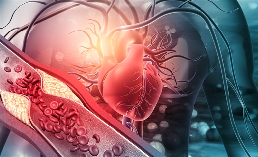 Caution when restarting clozapine: Potential for severe cardiovascular effects