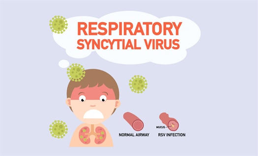 Prepare for unusual RSV epidemics due to COVID-19
