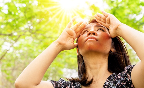 It’s hot out there: Drug-induced photosensitivity