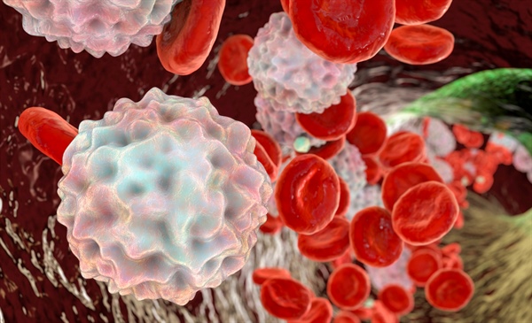 Research provides clarity on how steroid dose and timing influence leukocytosis