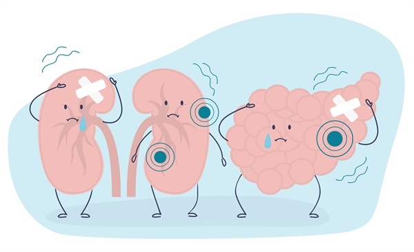 Finerenone with empagliflozin may improve CKD for patients with T2D