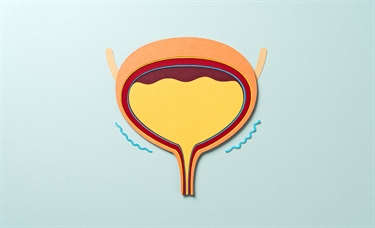 Hospital-onset UTIs beyond the catheter: A consensus framework